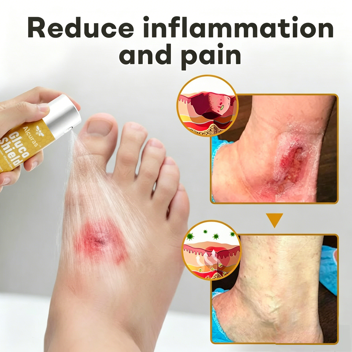 Alcuras⢠GlucoShield Bee Venom Wound SprayđŞ